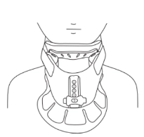 Immobilize Support Collar Immobilize Support Collar